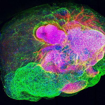 Green, pink. blue and yellow blobs and swirls on a black background